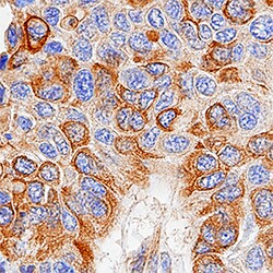 Human Cytokeratin 18 Antibody, R D Systems 100ug; Unlabeled:Antibodies,