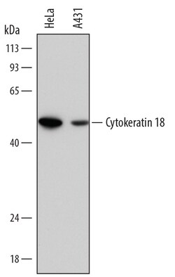 Human Cytokeratin 18 Antibody, R D Systems 100ug; Unlabeled:Antibodies,