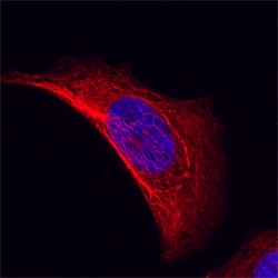 Human Cytokeratin 19 Antibody, R D Systems 100&mu;g; Unlabeled:Antibodies,
