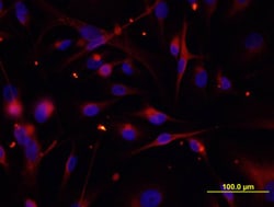 Human Cytokeratin 19 Antibody, R D Systems 100ug; Unlabeled:Antibodies,