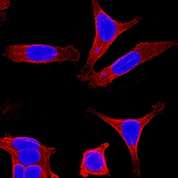Human Cytokeratin 8 Antibody, R D Systems 25&mu;g; Unlabeled:Antibodies,