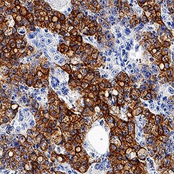 Human Cytokeratin 8 Antibody, R D Systems 25&mu;g; Unlabeled:Antibodies,