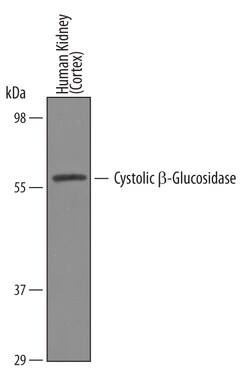 Human Cytosolic beta-Glucosidase/GBA3 Antibody, R D Systems 100&mu;g; Unlabeled:Antibodies,