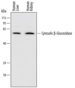 Human Cytosolic beta-Glucosidase/GBA3 Antibody, R D Systems 25&mu;g; Unlabeled:Antibodies,