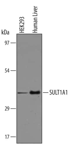 Human Cytosolic Sulfotransferase 1A1/SULT1A1 Antibody, R D Systems 25 &mu;g | Buy Online | R&D Systems | Fisher Scientific
