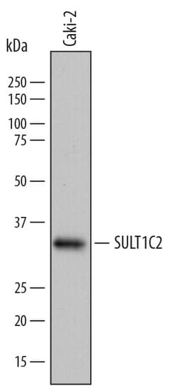 Human Cytosolic Sulfotransferase 1C2/SULT1C2 Antibody, R D Systems 25&mu;g;