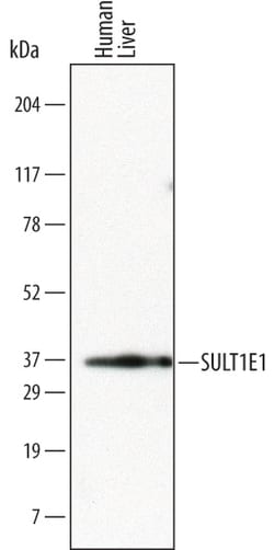 Human Cytosolic Sulfotransferase 1E1/SULT1E1 Antibody, R D Systems 100ug;
