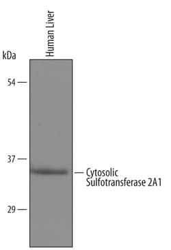 Human Cytosolic Sulfotransferase 2A1/SULT2A1 Antibody, R D Systems 100&mu;g;