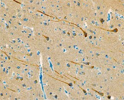 Human Cytosolic Sulfotransferase 4A1/SULT4A1 Antibody, R D Systems 25&mu;g;