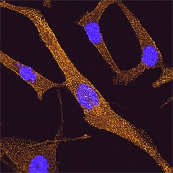 Human DAB2 Antibody, R D Systems 25μg; Unlabeled:Antibodies, Polyclonal
