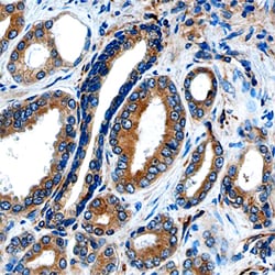 Human DAB2 Antibody, R D Systems 25μg; Unlabeled:Antibodies, Polyclonal