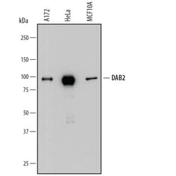 Human DAB2 Antibody, R D Systems 25μg; Unlabeled:Antibodies, Polyclonal