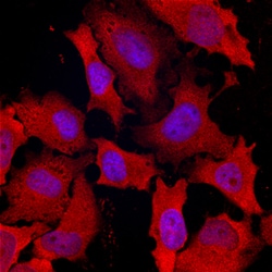 Human DAB2 Antibody, R D Systems 25μg; Unlabeled:Antibodies, Monoclonal