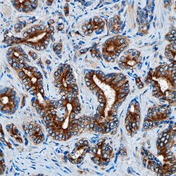 Human DAB2 Antibody, R D Systems 25μg; Unlabeled:Antibodies, Monoclonal