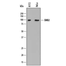 Human DAB2 Antibody, R D Systems 25μg; Unlabeled:Antibodies, Monoclonal