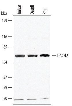 Human/Mouse DACH2 Antibody, R D Systems 100&mu;g; Unlabeled:Antibodies,