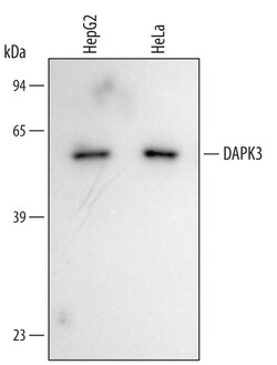 Human DAPK3/ZIPK Antibody, R D Systems 25&mu;g; Unlabeled:Antibodies, Polyclonal