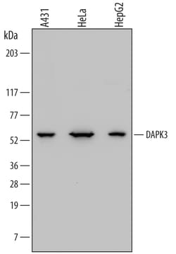 Human DAPK3/ZIPK Antibody, R D Systems 100ug; Unlabeled:Antibodies, Monoclonal