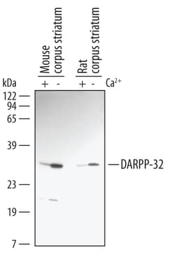 Mouse/Rat Phospho-DARPP-32 (T34) Antibody, R D Systems 25&mu;g; Unlabeled:Antibodies,
