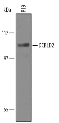 Human/Mouse DCBLD2/ESDN Antibody, R D Systems 25&mu;g; Unlabeled:Antibodies,