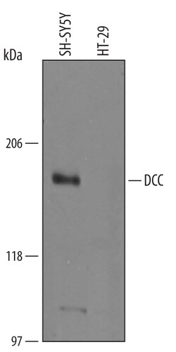 Human DCC Antibody, R D Systems 100&mu;g; Unlabeled:Antibodies, Polyclonal