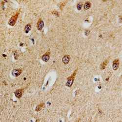 Human DCLK1 Antibody, R D Systems 100&mu;g; Unlabeled:Antibodies, Polyclonal