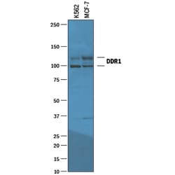 Human DDR1 Antibody, R D Systems 100&mu;g; Unlabeled:Antibodies, Polyclonal