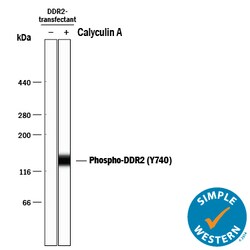Phospho-DDR2 (Y740) Rabbit anti-Human, Clone: 1119D, R D Systems 100&mu;L;