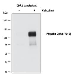 Phospho-DDR2 (Y740) Rabbit anti-Human, Clone: 1119D, R D Systems 100&mu;L;