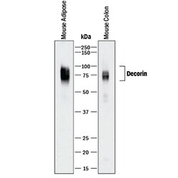 Mouse Decorin Antibody, R D Systems 100&mu;g; Unlabeled:Antibodies, Polyclonal