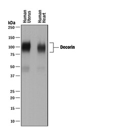 Human Decorin Antibody, R D Systems 25&mu;g; Unlabeled:Antibodies, Polyclonal