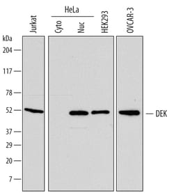 Human DEK Antibody, R D Systems 100ug; Unlabeled:Antibodies, Monoclonal