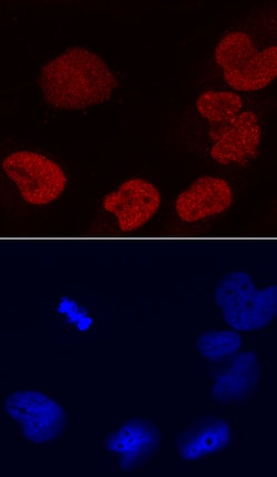 Human DEK Antibody, R D Systems 100ug; Unlabeled:Antibodies, Monoclonal