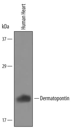 Human Dermatopontin Antibody, R D Systems 25&mu;g; Unlabeled:Antibodies,