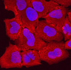 Human/Mouse Desmocollin-1 Antibody, R D Systems 100ug; Unlabeled:Antibodies,