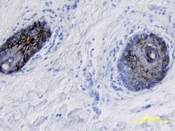 Human Desmoglein-1 Antibody, R D Systems 100&mu;g; Unlabeled:Antibodies,