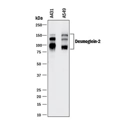 Human Desmoglein-2 Antibody, R D Systems 25&mu;g; Unlabeled:Antibodies,