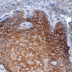 Human Desmoglein-3 Antibody, R D Systems 500ug; Unlabeled:Antibodies, Monoclonal
