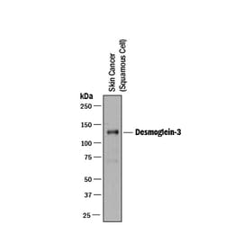 Human Desmoglein-3 Antibody, R D Systems 500ug; Unlabeled:Antibodies, Monoclonal