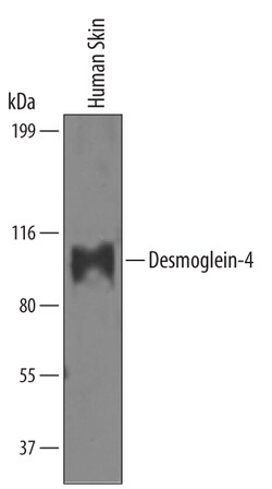 Human Desmoglein-4 Antibody, R D Systems 25&mu;g; Unlabeled:Antibodies,