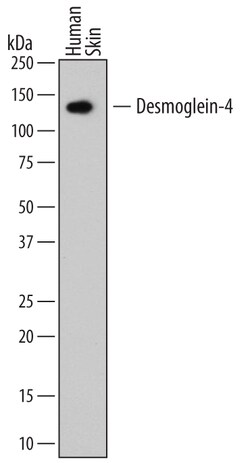 Human Desmoglein-4 Antibody, R D Systems 100ug; Unlabeled:Antibodies, Monoclonal