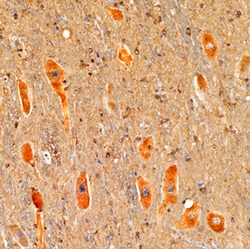 Human/Mouse DGK-epsilon Antibody, R D Systems 100&mu;g; Unlabeled:Antibodies,
