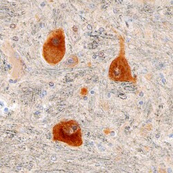 Human/Mouse/Rat DGK-epsilon Antibody, R D Systems 25&mu;g; Unlabeled:Antibodies,