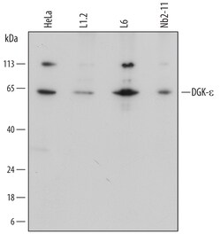 Human/Mouse/Rat DGK-epsilon Antibody, R D Systems 25&mu;g; Unlabeled:Antibodies,