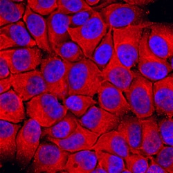 Human Dihydrofolate Reductase/DHFR Antibody, R D Systems 100&mu;g; Unlabeled:Antibodies,