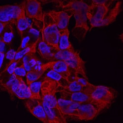 Human DISP1 Antibody, R D Systems 100&mu;g; Unlabeled:Antibodies, Polyclonal