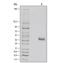 R D Systems Recombinant Mouse Dkk-1 Protein Lyophilized from a 0.2&mu;m filtered solution in PBS with BSA as a carrier protein. | Buy Online | R&amp;D Systems&trade; | Fisher Scientific