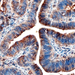 Human Dkk-1 Antibody, R D Systems:Antibodies:Primary Antibodies