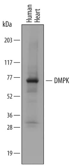 Human DMPK Antibody, R D Systems 100ug; Unlabeled:Antibodies, Monoclonal