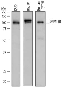 Human DNMT3B Antibody, R D Systems 25&mu;g; Unlabeled:Antibodies, Polyclonal